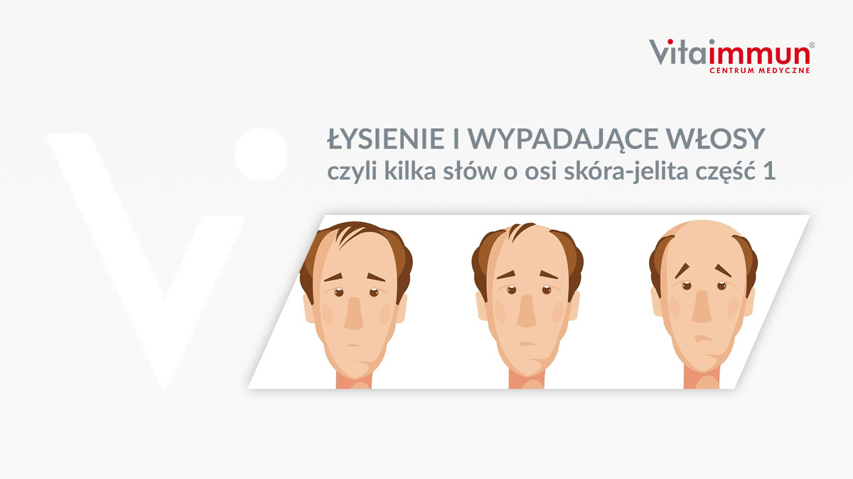 ŁYSIENIE I WYPADAJĄCE WŁOSY czyli kilka słów o osi skóra-jelita część 1