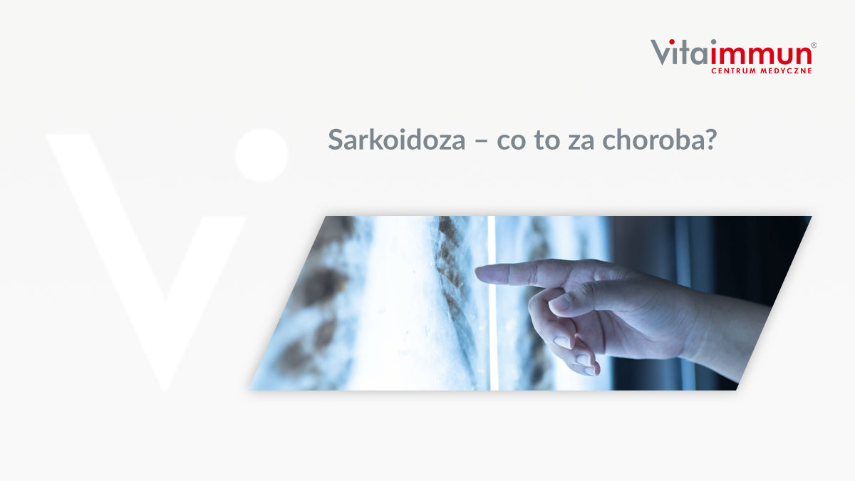 Sarkoidoza – co to za choroba?